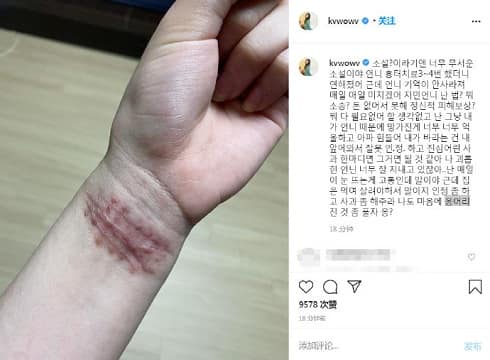 AOA前成员权珉娥曾受队内霸凌 曾试图割腕自杀_韩饭网